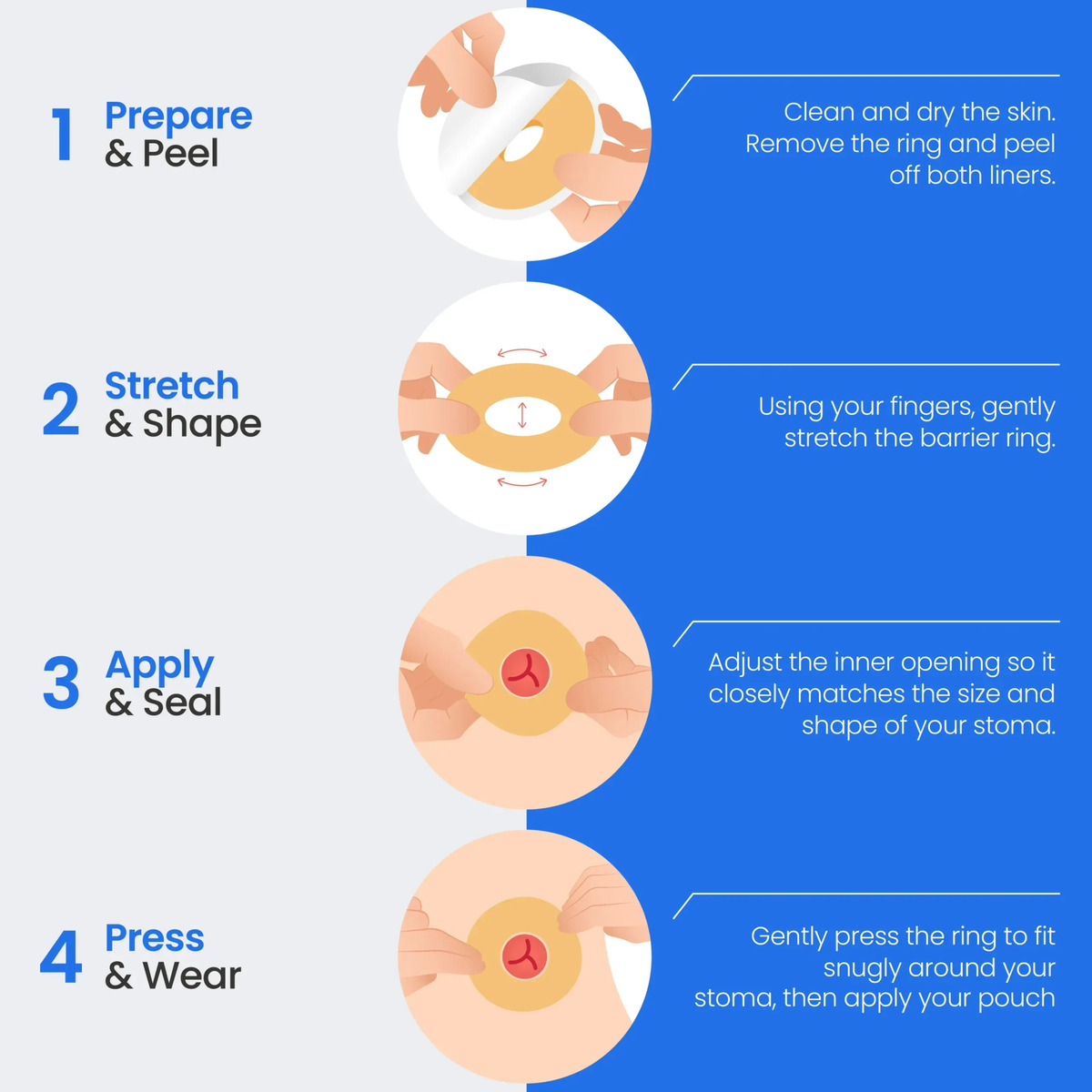 Safe-n-Simple Conforming Skin Barrier Ring application steps