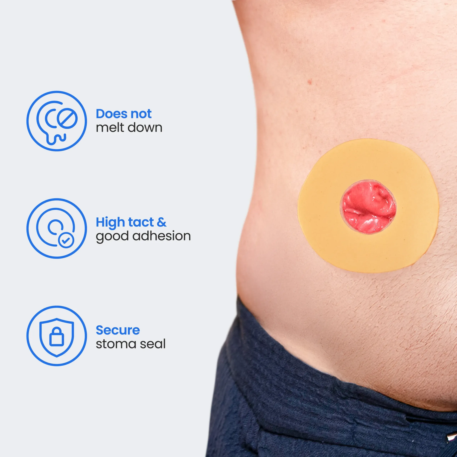 Safe-n-Simple Conforming Skin Barrier Ring secure-seal features