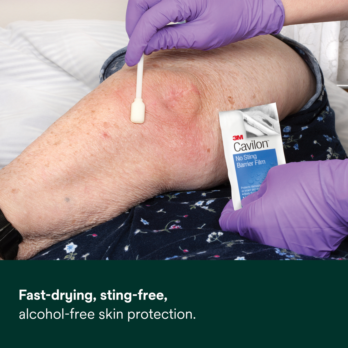 3M Cavilon No Sting Barrier Film fast-drying alcohol-free skin protection