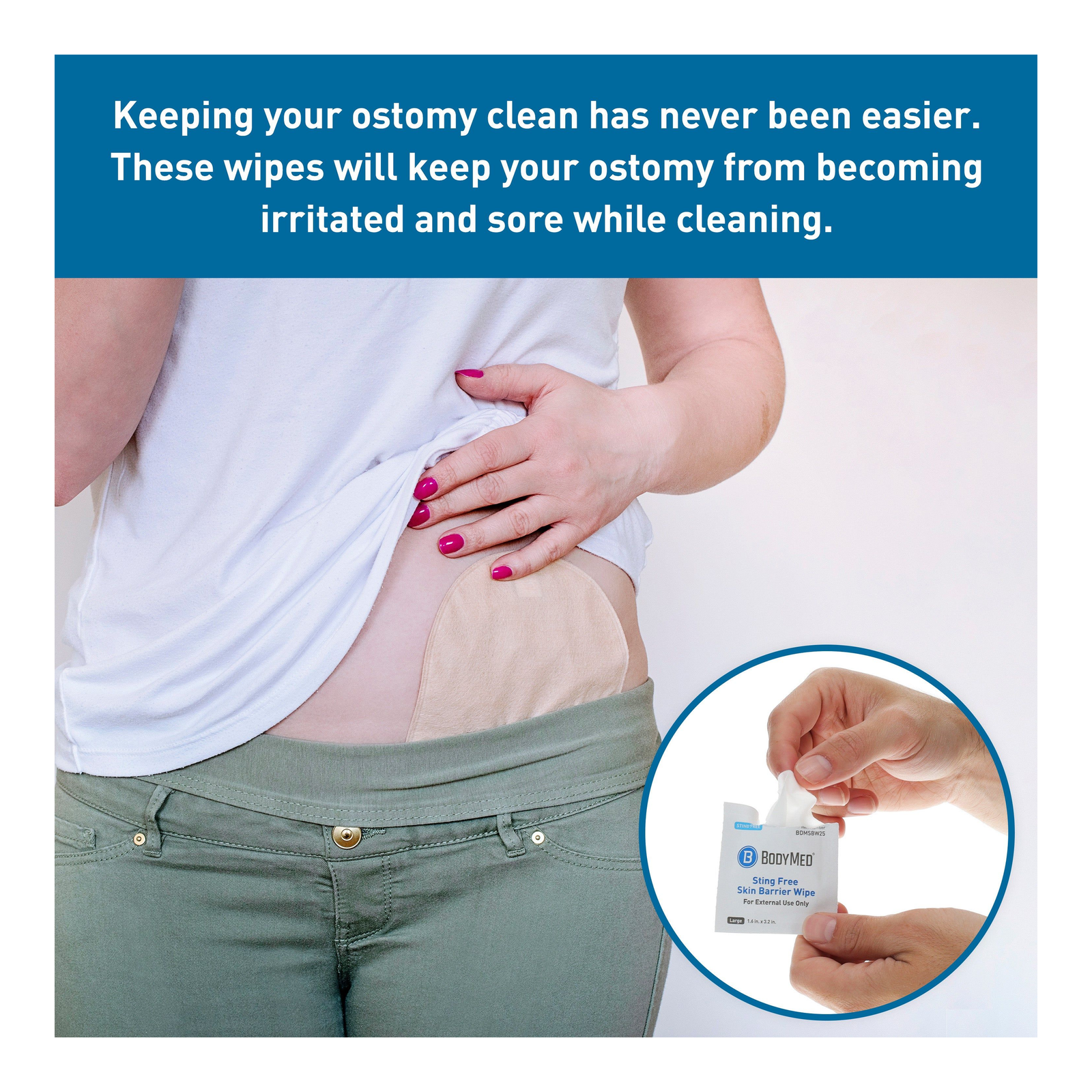 BodyMed Sting Free Skin Barrier Wipe ostomy-care use illustration