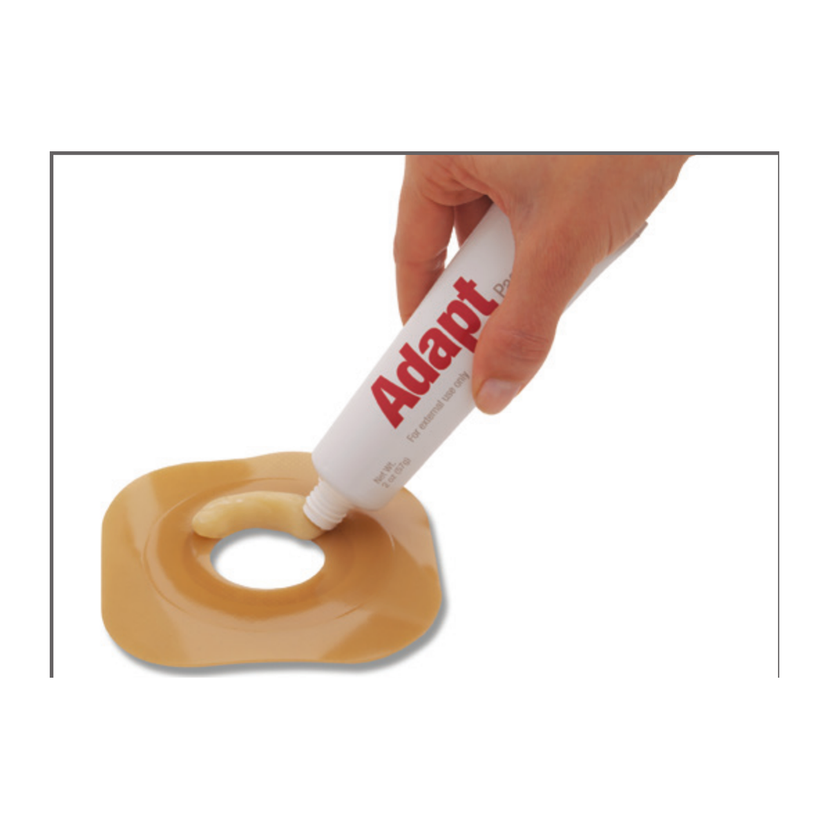 Applying Hollister Adapt skin barrier paste around a skin barrier opening