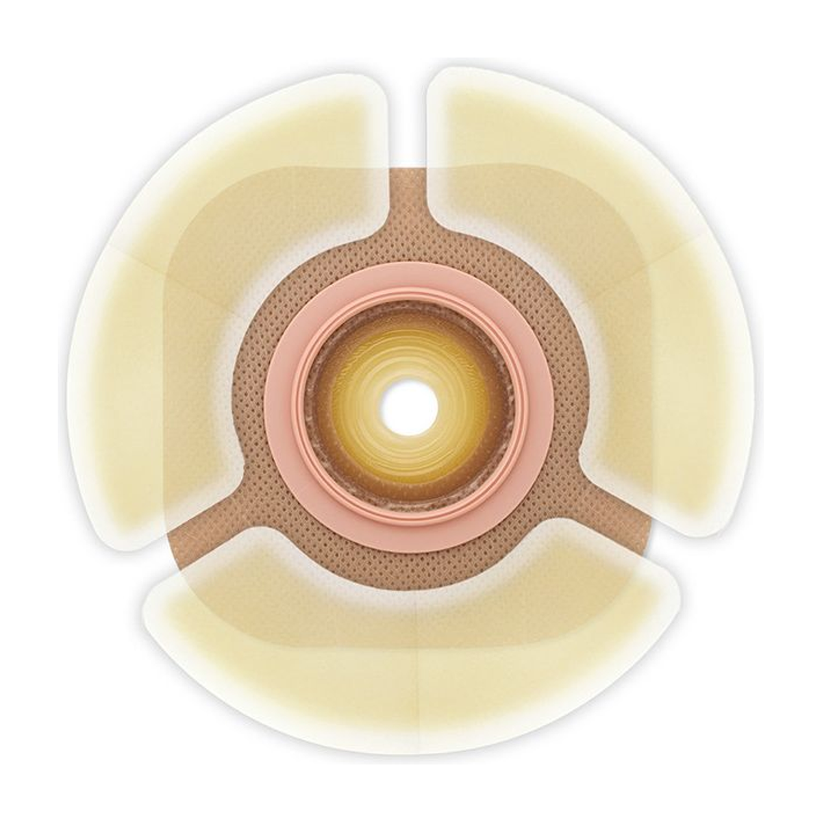 Hollister CeraPlus Barrier Extenders applied around an ostomy barrier