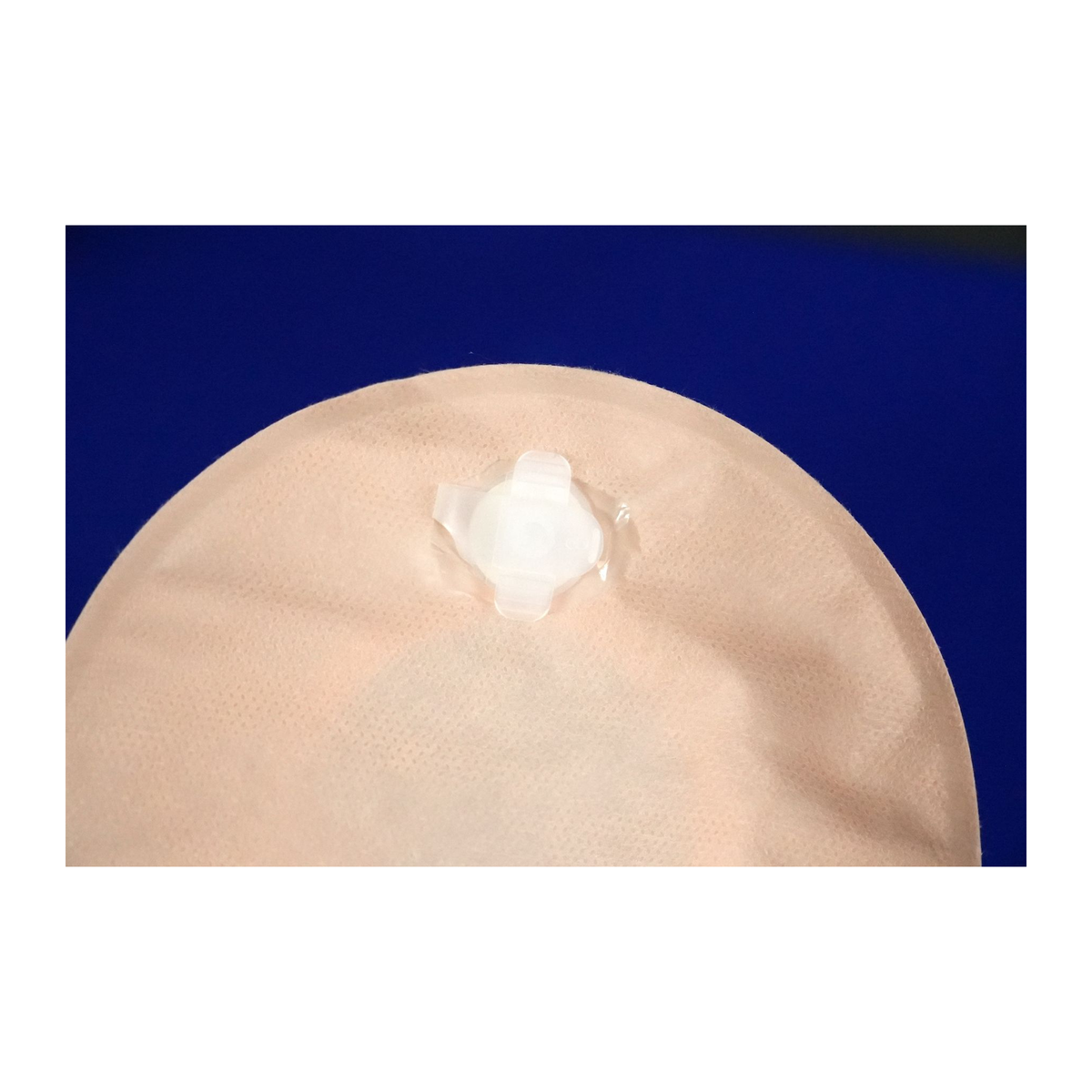 Osto-EZ-Vent installed on an ostomy pouch