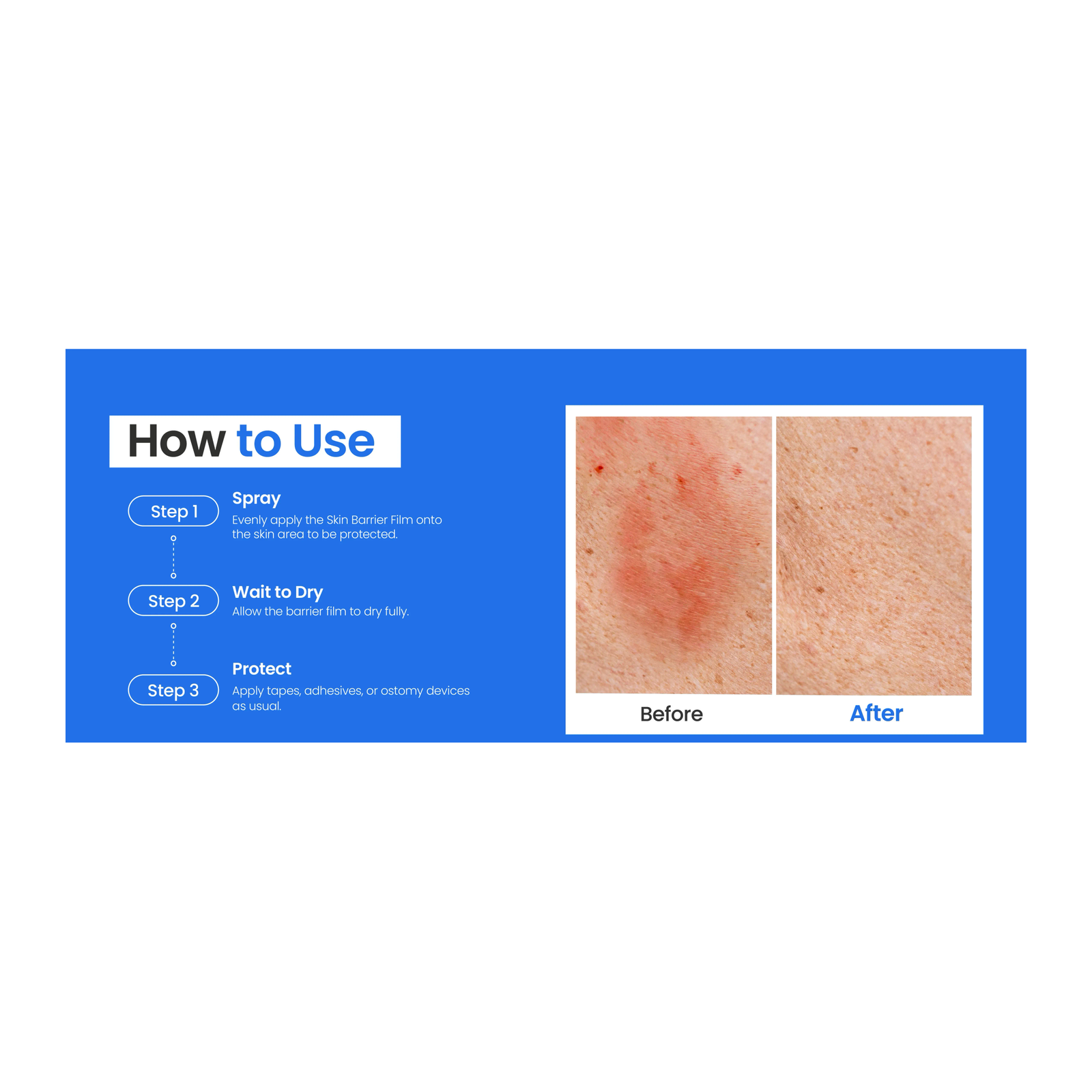 Safe-n-Simple No-Sting Skin Barrier Spray application steps