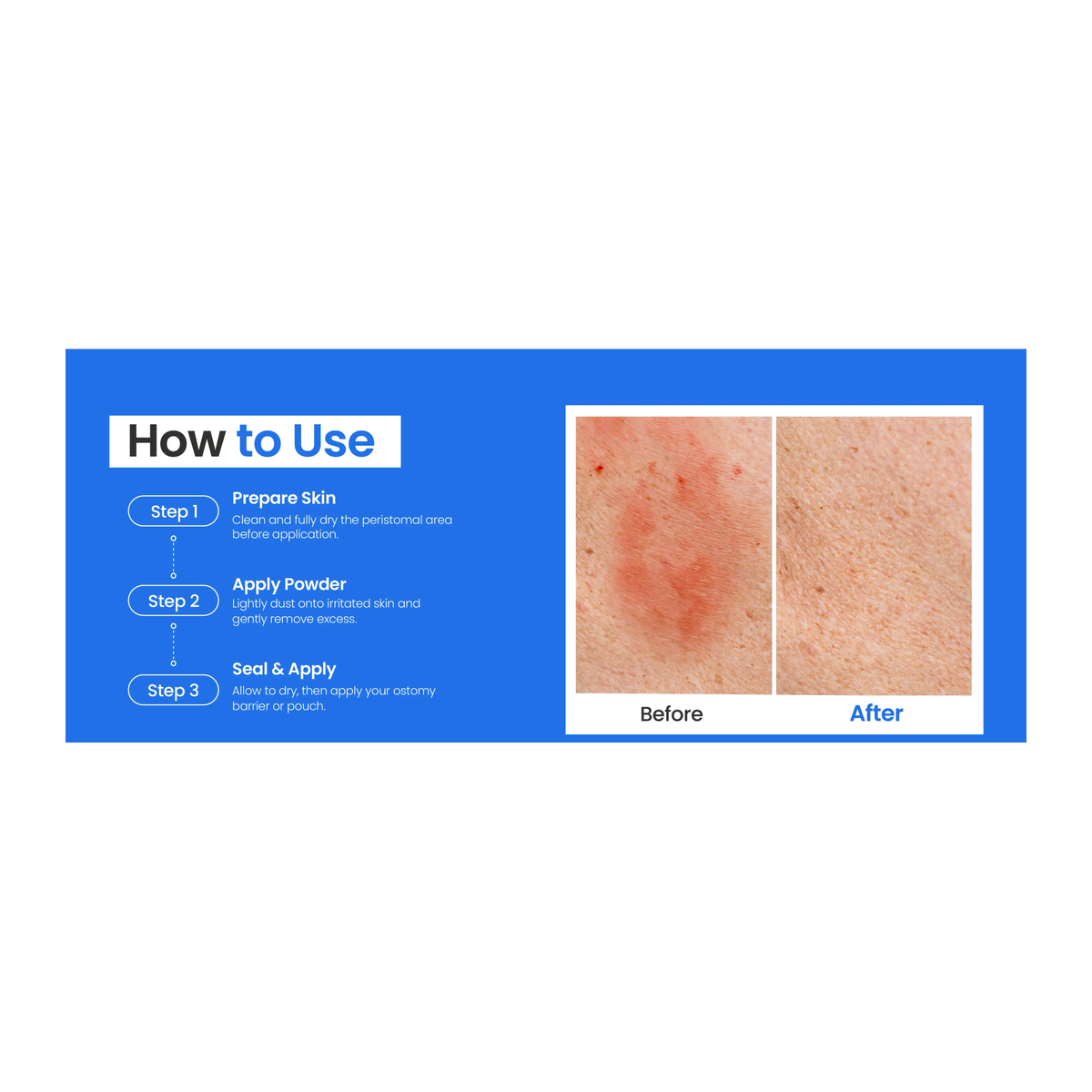 Safe-n-Simple Skin Barrier Powder application steps