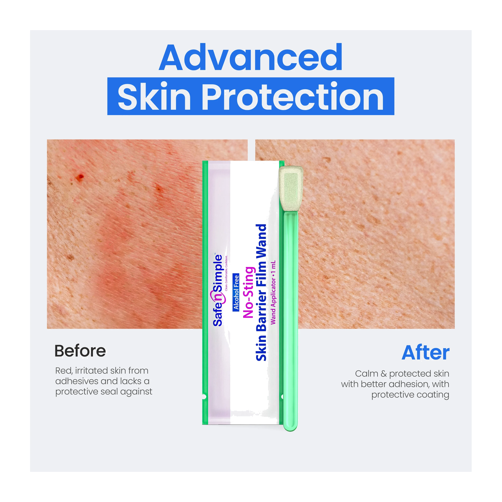 Safe-n-Simple Skin Barrier Film Wand skin protection illustration