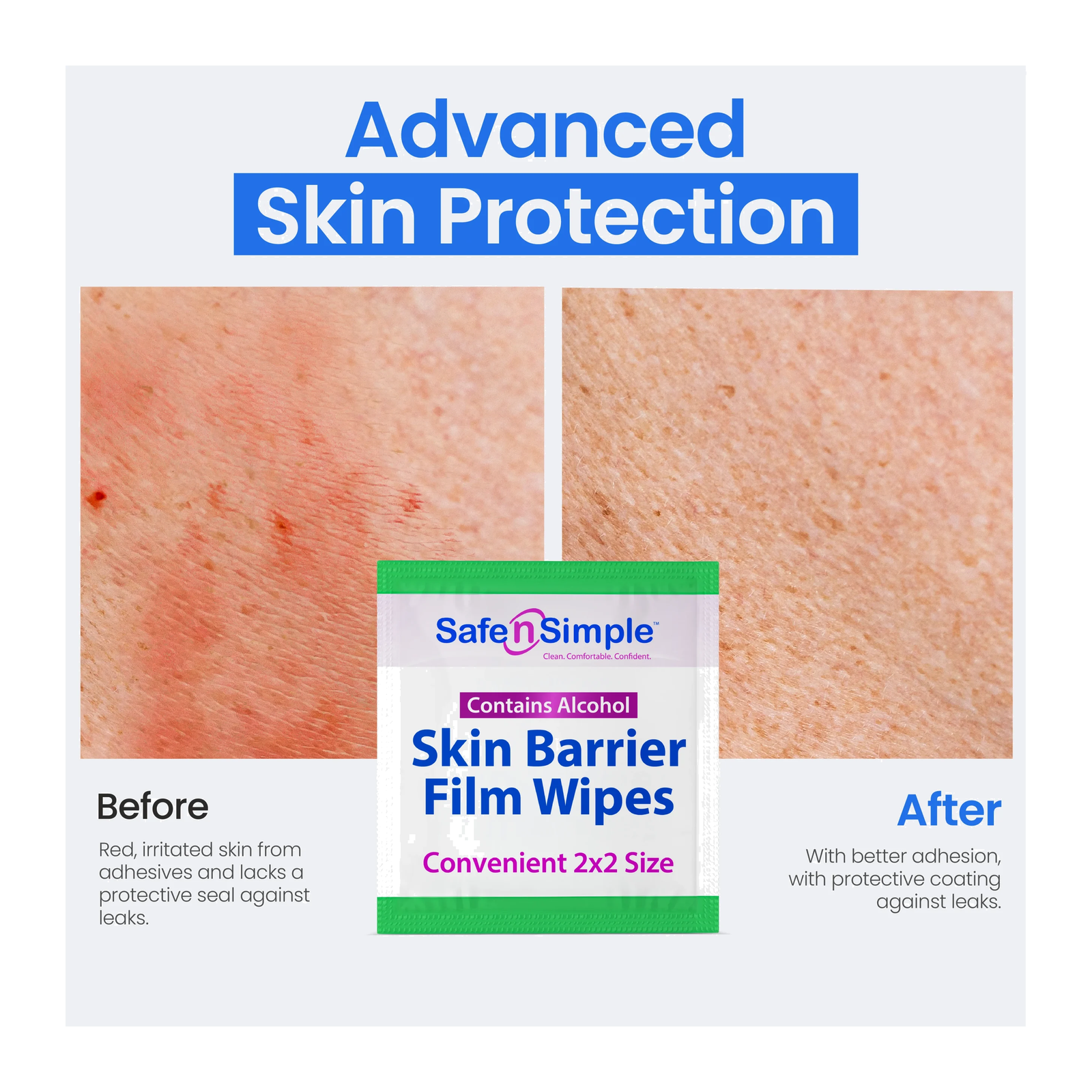 Safe-n-Simple Skin Barrier Film Wipes skin protection illustration